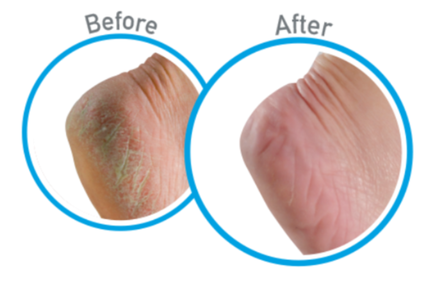 Reveal Soft, Confident Skin Every Day!